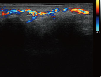 指尖血流，C 模式
